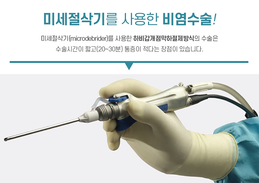 미세절삭기(microdebrider)